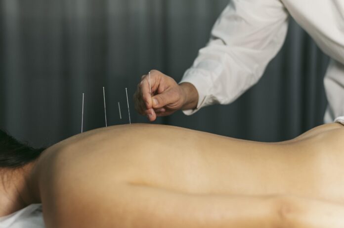 acupuncture-process fonte freepik