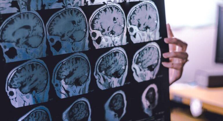 OMS afirma que até 45% do risco de demência pode ser prevenido ou adiado