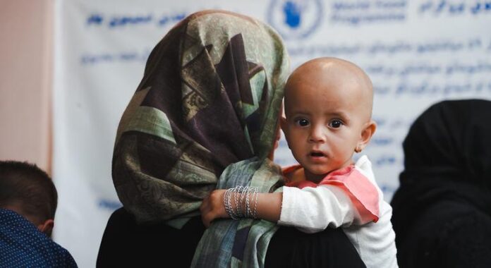 Unicef alerta para colapso no auxílio a 3,7 milhões de Unicef alerta para colapso no auxílio a 3,7 milhões de crianças afegãs desnutridas