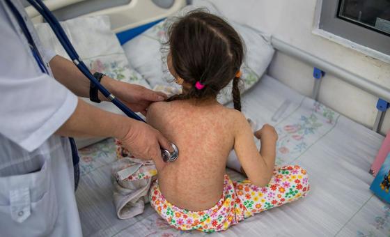 Opas vê risco “muito alto” de propagação do sarampo na Opas vê risco “muito alto” de propagação do sarampo na América do Sul